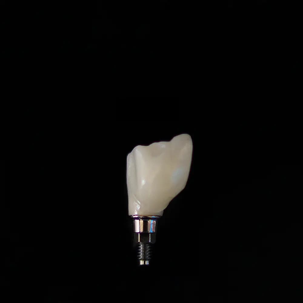 Implant sa nadogradnjom