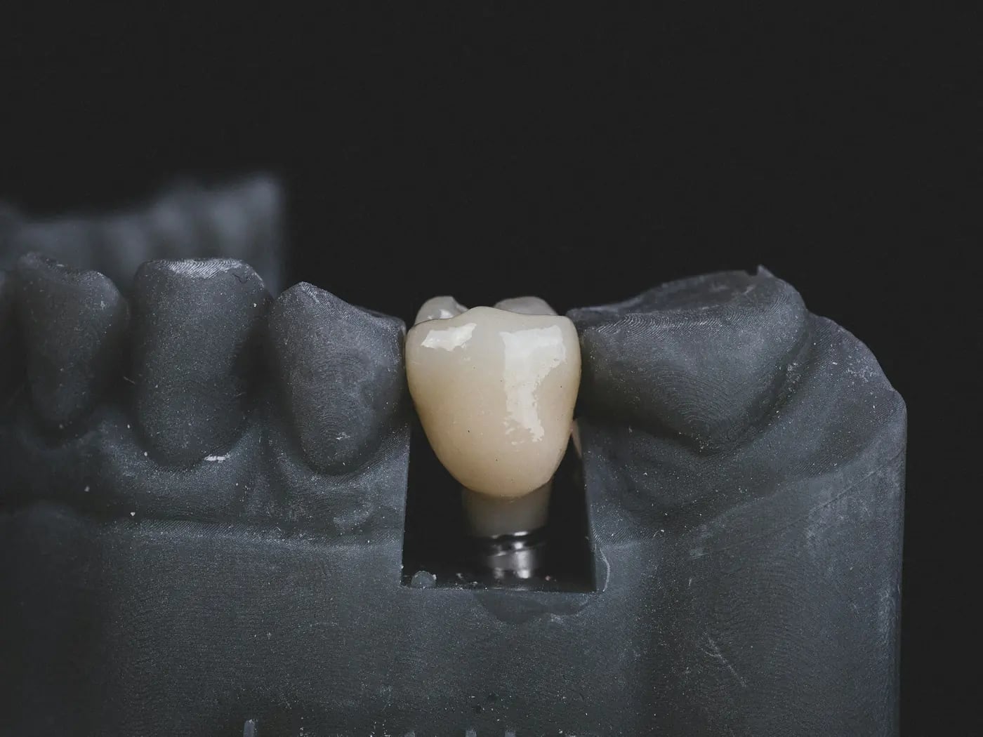 Implant premium sistema (Švajcarska)